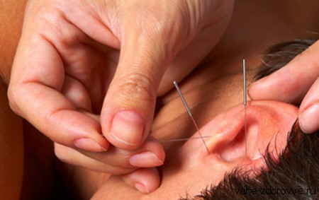 4826692_Auriculotherapy (450x283, 31Kb)