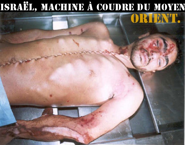 Machine Coudre Organes/5046362_Machine_Coudre (650x507, 129Kb)