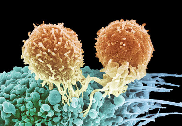 1357627075_M1320895T_lymphocytes_and_cancer_cell_SEMSPL (600x414, 366Kb)