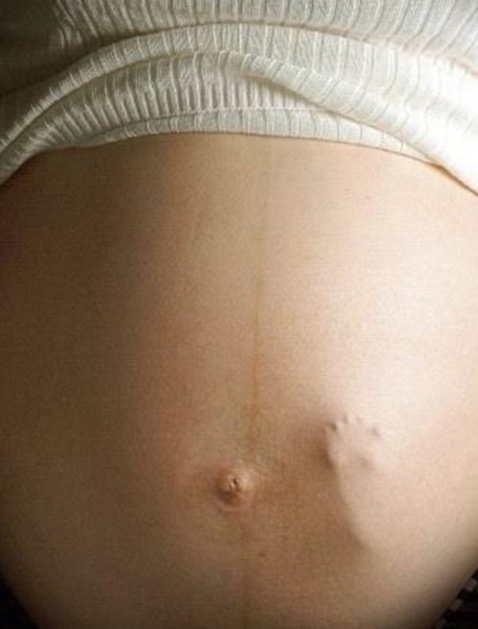 4337340_Baby_In_Womb (532x700, 79Kb)