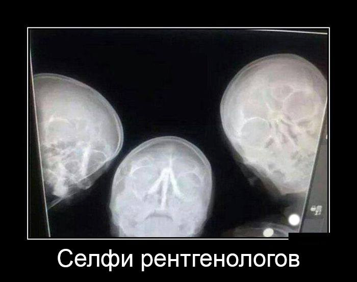 Рентген юмор картинки