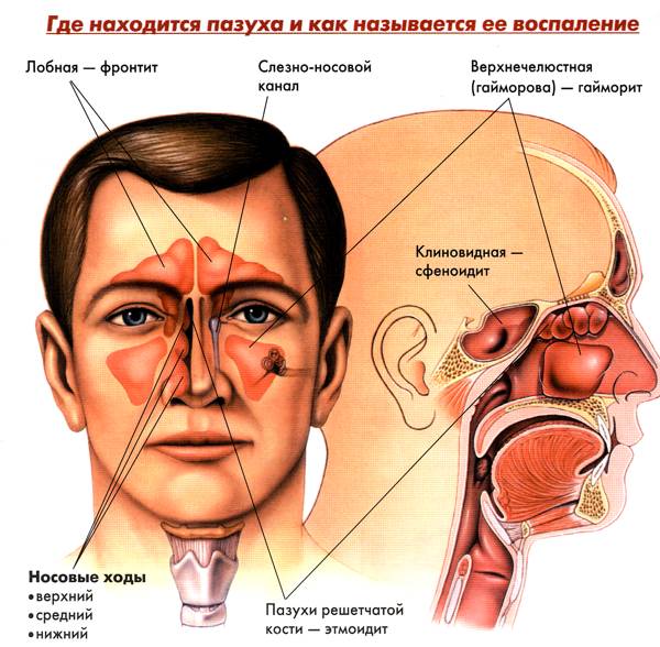 Искривление Носовой Перегородки Снижение Слуха