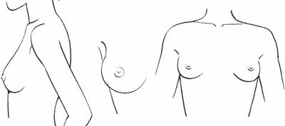 breast04-02 (400x177, 7Kb)