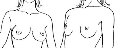 breast05-05 (400x167, 10Kb)