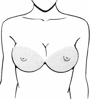 breast14-03 (299x331, 12Kb)