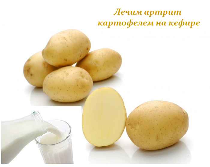 лечение ревматоидного артрита сырой картошкой