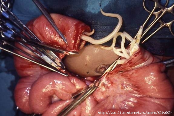   ,      ,    ,      ,   ,   ,      ,    ,       ,     ,     ,     ,   ,      ,    ,/6210665_Ascaris_infection_Difficult_intestinal_anastamosis__joining_up_of_two_ends_clearly_if_we_cut_out_a_section_of_bowel_were_left_with_two_ends_that_need_to_be_joined_up_South_Africa_15806559973 (575x385, 125Kb)