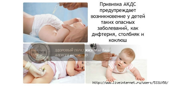 Прививка акдс последствия. Прививка АКДС последствия у детей. АКДС фото после прививки.