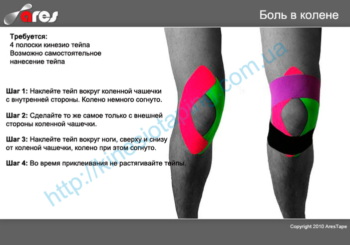 Тейпирование при боли в колене схема