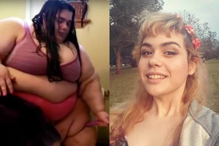 Этой толстушке врач отказался делать операцию. Через год она сама изменилась до неузнаваемости!