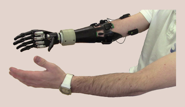 fig3-robotic-hand (620x358, 51Kb)