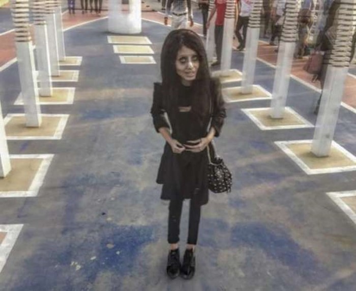 «Девушка зомби» с 50 пластическими операциями призналась, что всех обманула