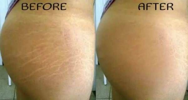 original (600x320, 17Kb)