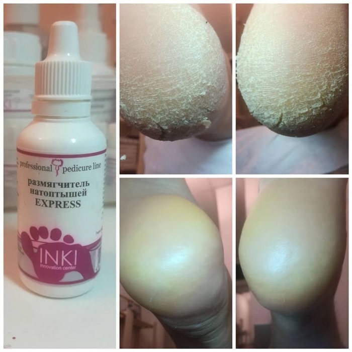 5951663_inki (700x700, 243Kb)