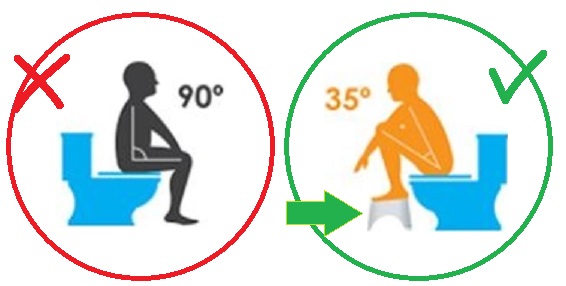 Дефекация это. Подставка для опорожнения кишечника. Правильная поза для туалета кишечник. Опорожнение кишечника с подставкой для ног. Чистка кишечника в туалете.