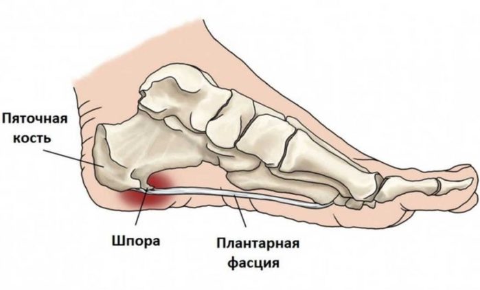 5745884_pyatochnaya_shpora (700x422, 30Kb)