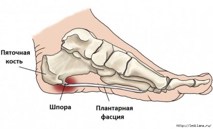 pyatochnaya_shpora (700x422, 84Kb)