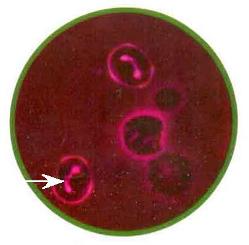 gemoscan-inficya (249x245, 14Kb)