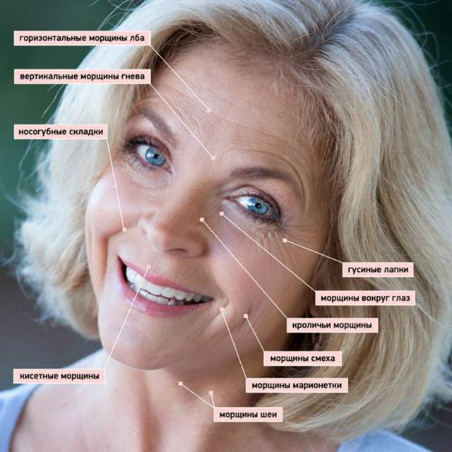 morschiny-shema (640x640, 221Kb)