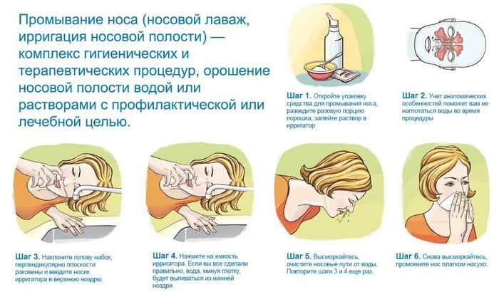 Как промывать нос: 7 устройств