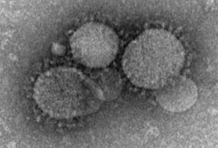Откуда взялись смертельно опасные коронавирусы?