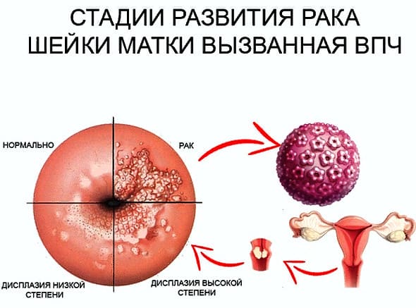 rak-shejki-matki (590x437, 33Kb)